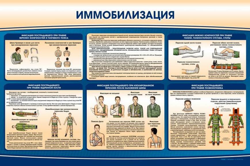 Стенд "Иммобилизация"